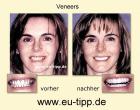 Zahnbehandlung Urlaub - 1 Woche Euro 299 all inclusive